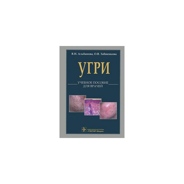 Угри пособие для врачей Угри пособие для врачей