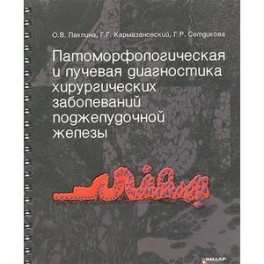 Патоморфологическая и лучевая диагностика хирургических заболеваний поджелудочной железы