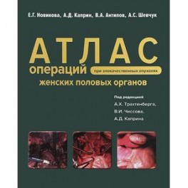 Атлас операций при злокачественных опухолях женских половых органов