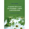 Туберкулез глаз и сходные с ним заболевания. Руководство для врачей