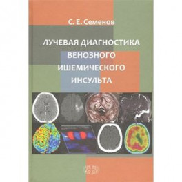 Лучевая диагностика венозного ишемического инсульта