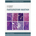 Патология матки. Руководство для врачей