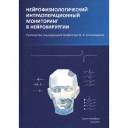 Нейрофизиологический интраоперационной мониторинг в нейрохирургии. Руководство