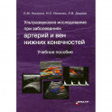 Ультразвуковое исследование при заболеваниях артерий и вен нижних конечностей