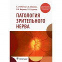 Патология зрительного нерва