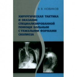 Хирургическая тактика и оказание специализированной помощи больным с тяжёлыми формами сколиоза