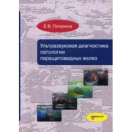 Ультразвуковая диагностика патологии паращитовидных желез