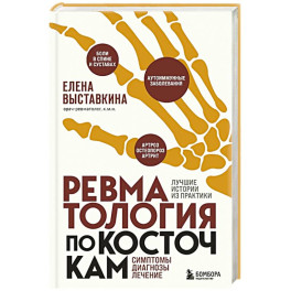 Ревматология по косточкам. Симптомы, диагнозы, лечение