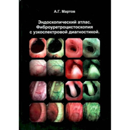 Эндоскопический атлас. Фиброуретроцистоскопия с узкоспектровой диагностикой