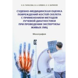 Судебно-медицинская оценка повреждений костей скелета с применением методов лучевой диагностики