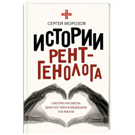 Истории рентгенолога. Смотрю насквозь. Диагностика в медицине и в жизни