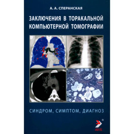 Заключение в таракальной компьютерной  томографии. Симптом, синдром, диагноз.