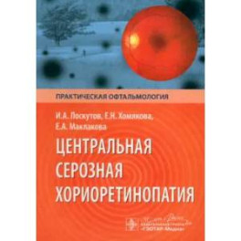 Центральная серозная хориоретинопатия