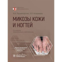 Микозы кожи и ногтей