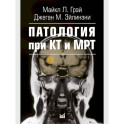 Патология при КТ и МРТ