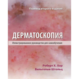 Дерматоскопия. Иллюстрированное руководство для самообучения