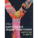 Каротидная эндартерэктомия. Хирургия в цвете