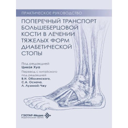 Поперечный транспорт большеберцовой кости в лечении тяжелых форм диабетической стопы. Практическое руководство