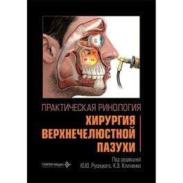 Практическая ринология:хирургия верхнечелюстной пазухи