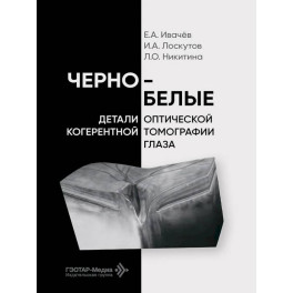 Черно-белые детали оптической когерентной томографии глаза