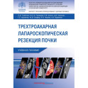 Трехтроакарная лапароскопическая резекция почки