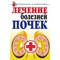 Лечение болезней почек